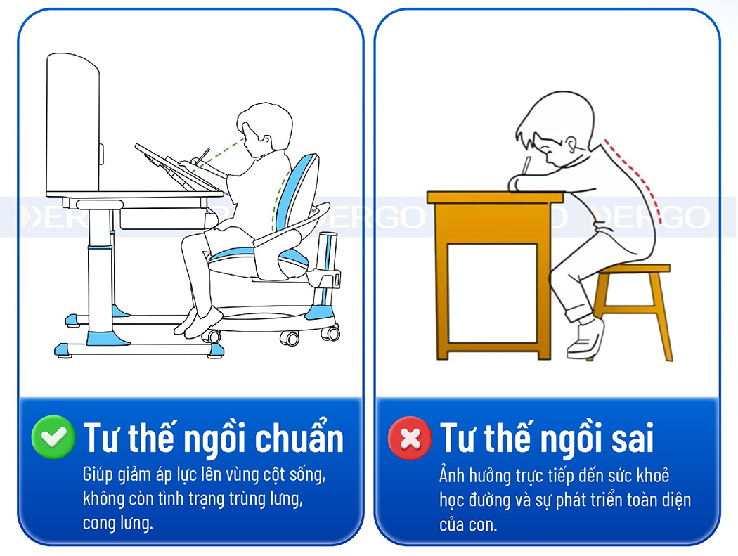 Lựa chọn BGTM15 để giúp trẻ chống gù chống cận